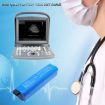 Chison BT-2500 Battery for ECO 1 Portable Ultrasound 33-00012-00 - 4